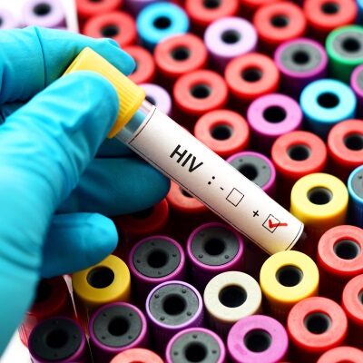 cure palliative e hiv